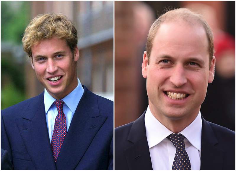 Prince William hair, young vs now