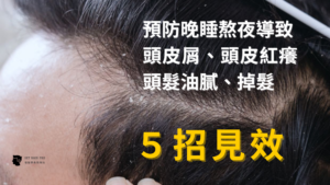 預防晚睡熬夜導致 頭皮屑、頭皮紅癢頭髮油膩、掉髮，5招見效